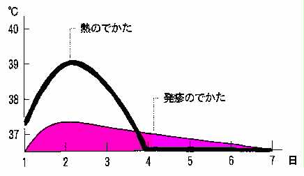 熱・発疹のでかたのグラフ