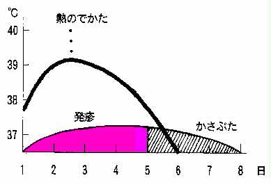 熱・発疹のでかたのグラフ