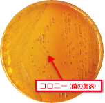 腸管出血性大腸菌O157のコロニー（菌の集落）