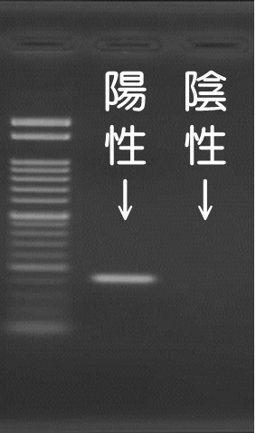 DNAの配列を測定します