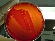 溶血性レンサ球菌の発育した培地です