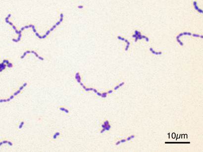 溶血性レンサ球菌の顕微鏡写真です