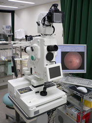 眼底カメラ・蛍光眼底撮影装置の写真2