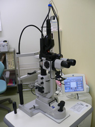 レーザー(光凝固装置)の写真2