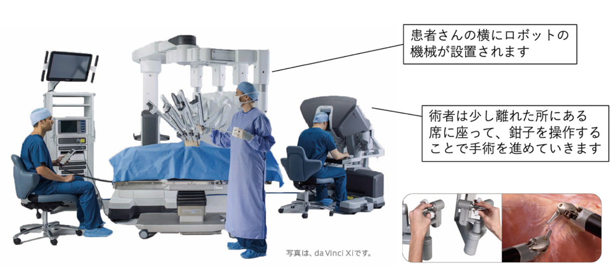 ロボット支援下手術の画像