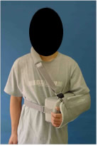 スリング固定の写真