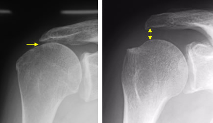 エックス線検査の写真