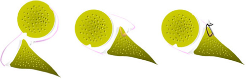脱臼した状態から手術後の状態までの比較画像