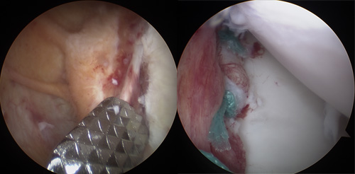 手術前後の比較写真