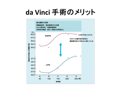 da Vinci手術のメリットを表すグラフ
