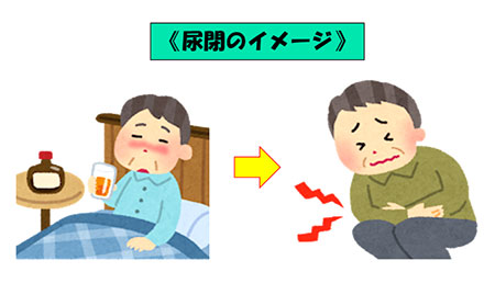 尿閉のイメージ